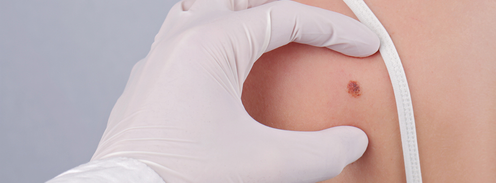 Dermatologia